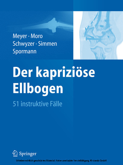 Der kapriziöse Ellbogen