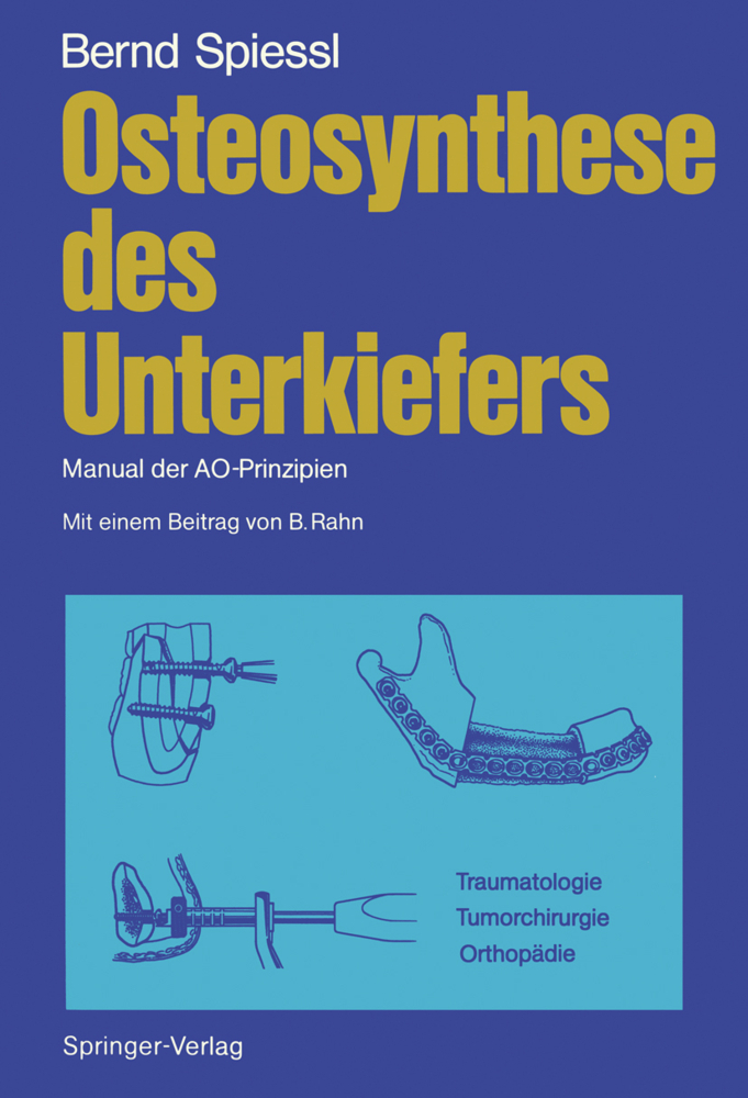 Osteosynthese des Unterkiefers