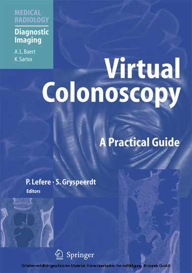 Virtual Colonoscopy