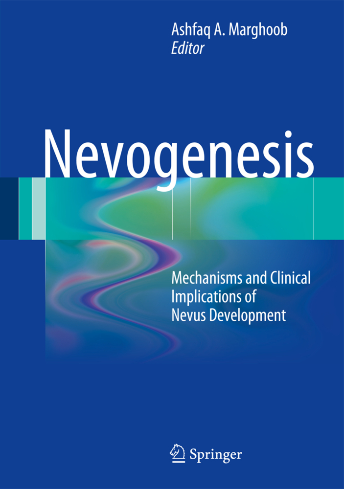 Nevogenesis