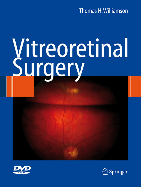 Vitreoretinal Surgery