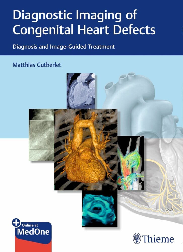 Diagnostic Imaging of Congenital Heart Defects