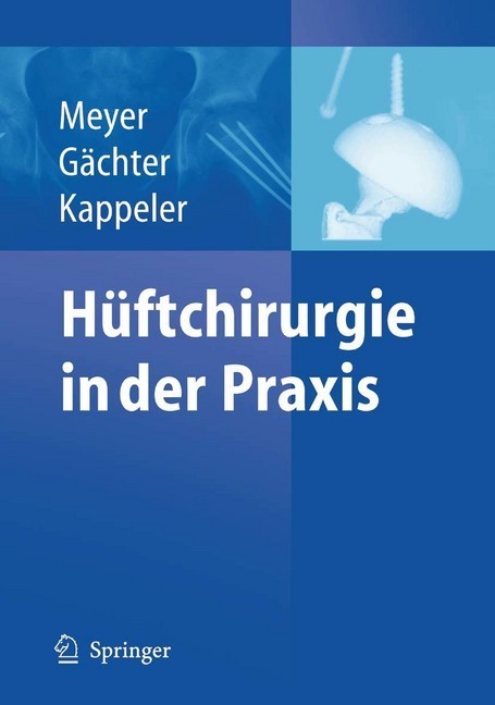 Hüftchirurgie in der Praxis