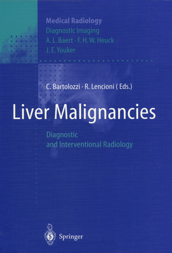 Liver Malignancies