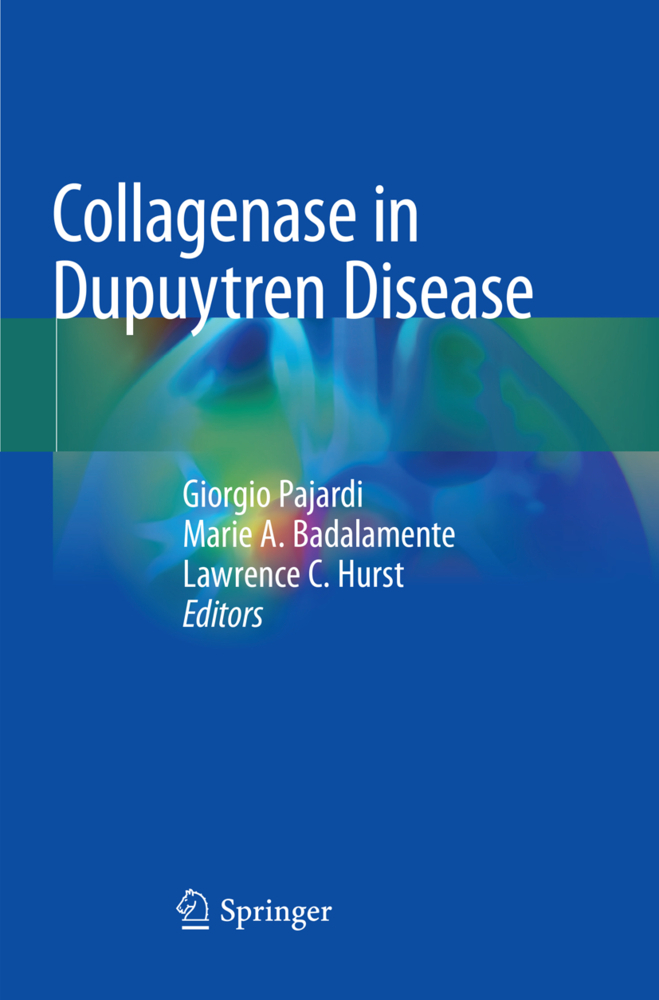 Collagenase in Dupuytren Disease