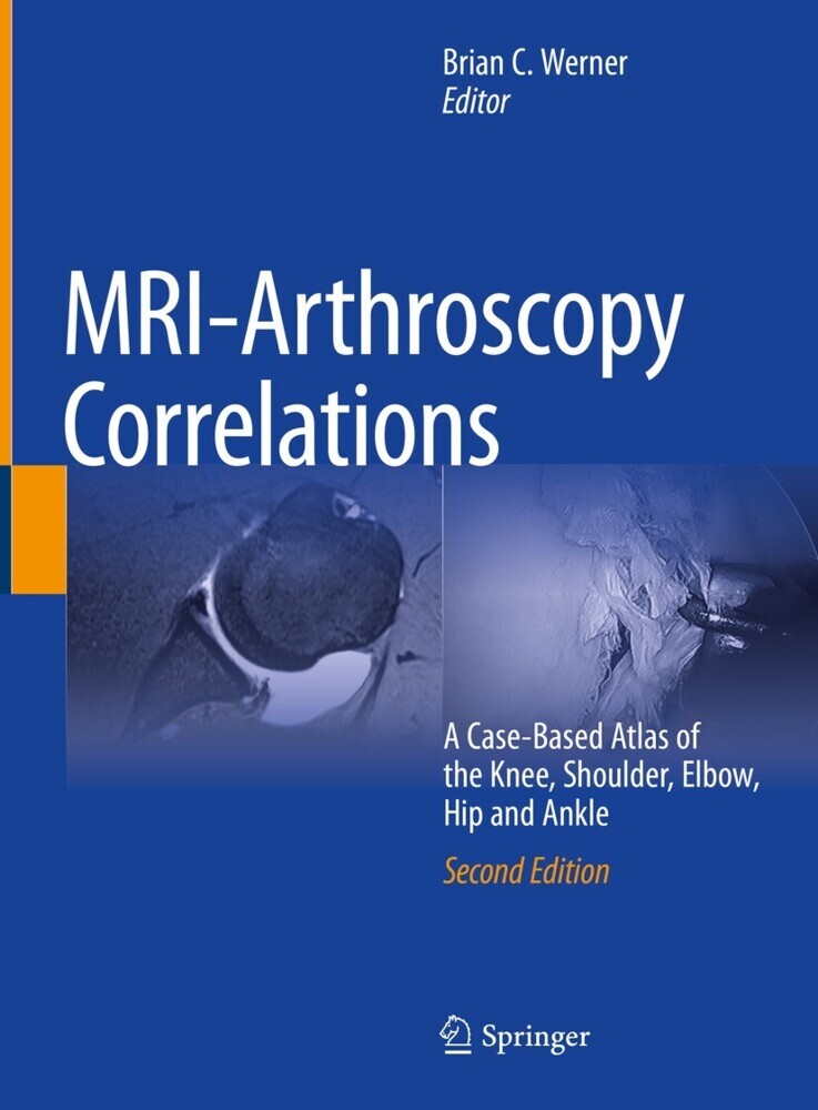 MRI-Arthroscopy Correlations