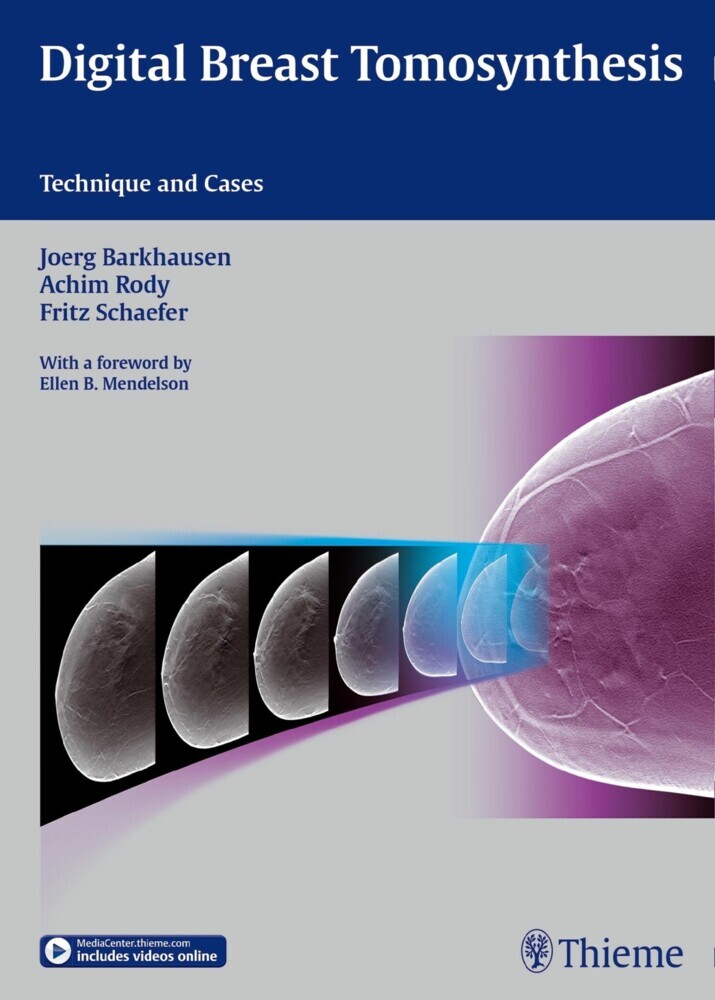 Digital Breast Tomosynthesis