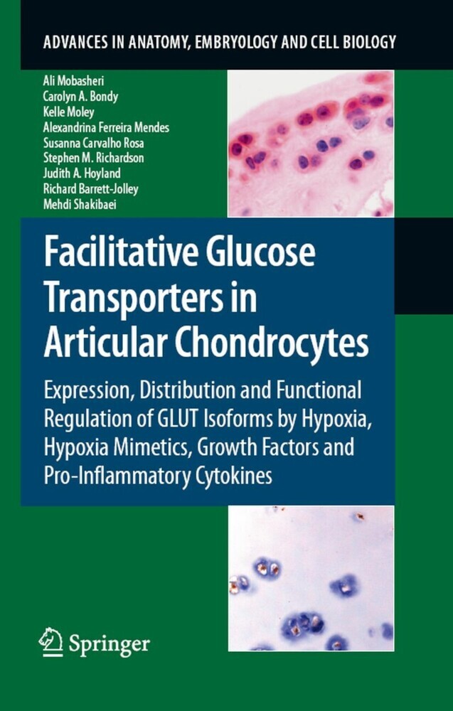 Facilitative Glucose Transporters in Articular Chondrocytes