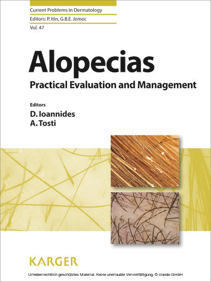 Alopecias - Practical Evaluation and Management