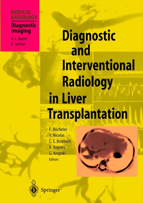 Diagnostic and Interventional Radiology in Liver Transplantation