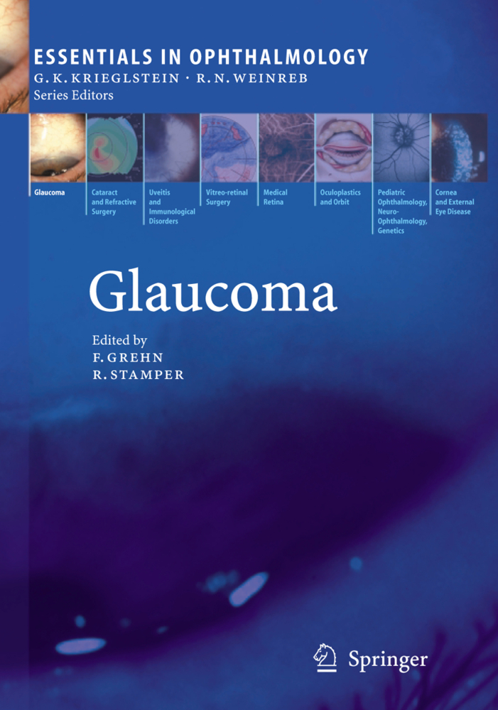 Glaucoma. Vol.2