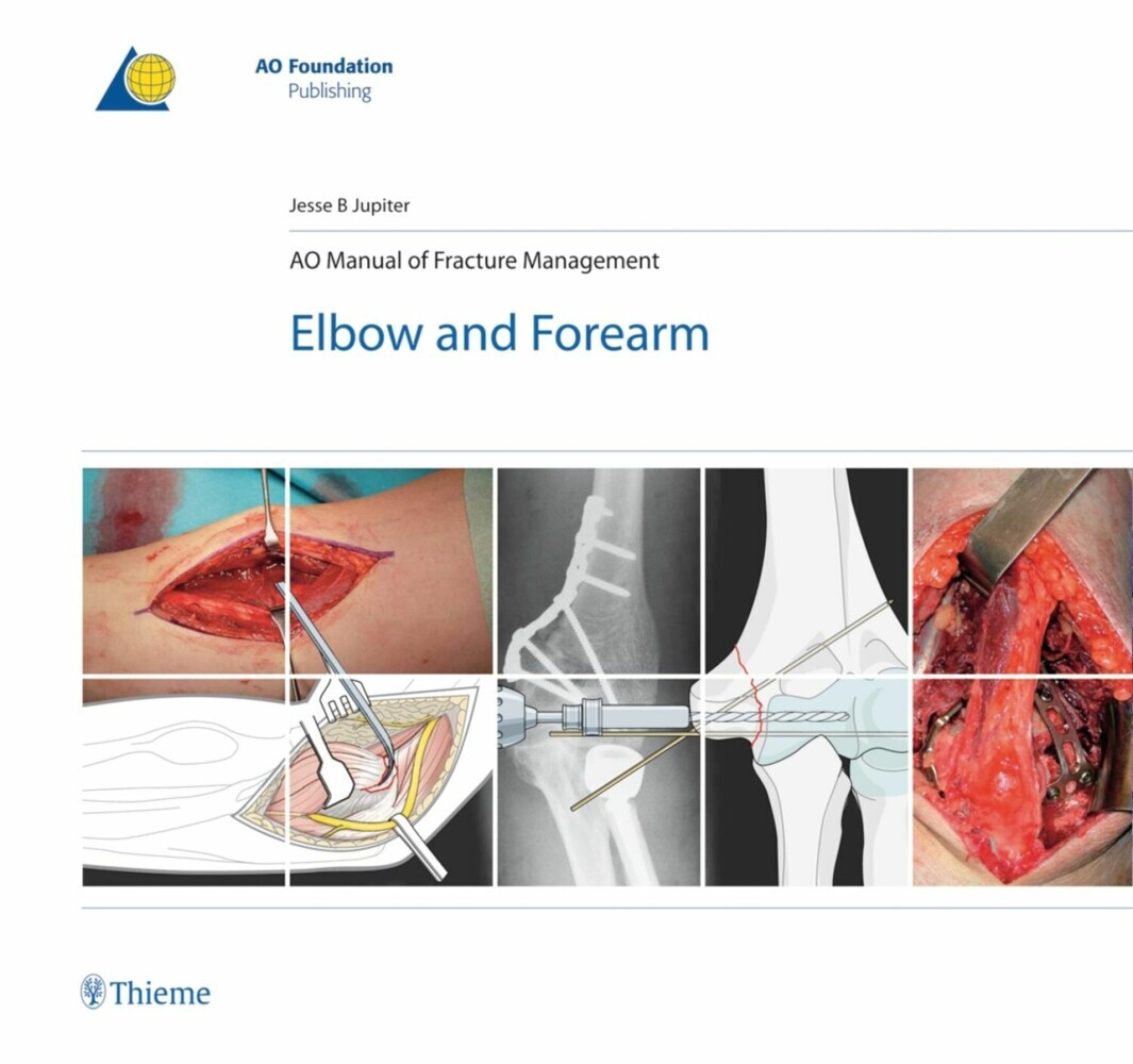AO Manual of Fracture Management - Elbow and Forearm