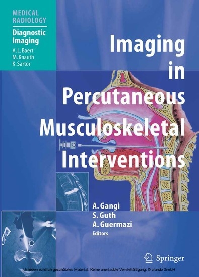 Imaging in Percutaneous Musculoskeletal Interventions