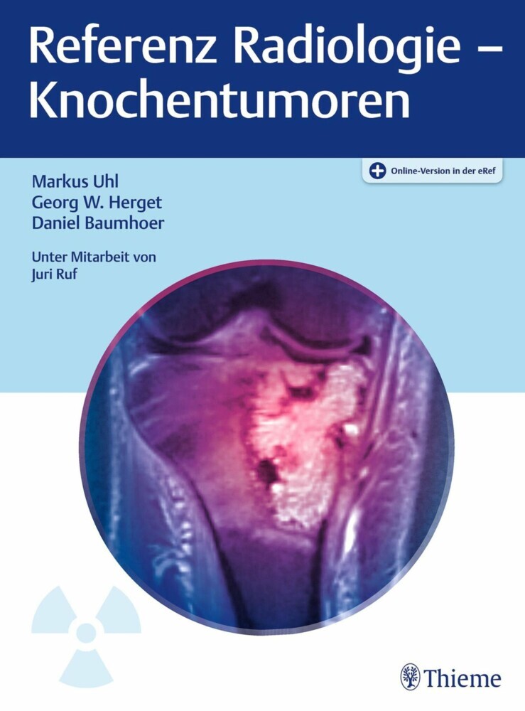 Referenz Radiologie - Knochentumoren