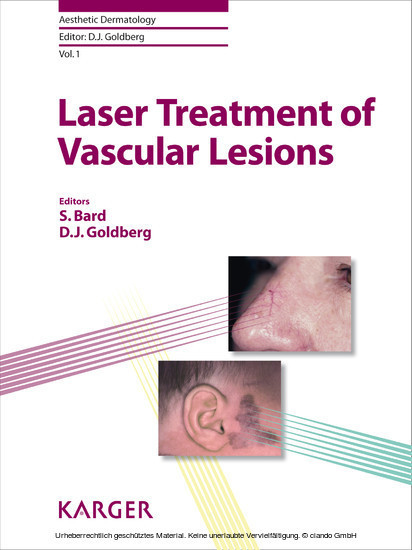 Laser Treatment of Vascular Lesions