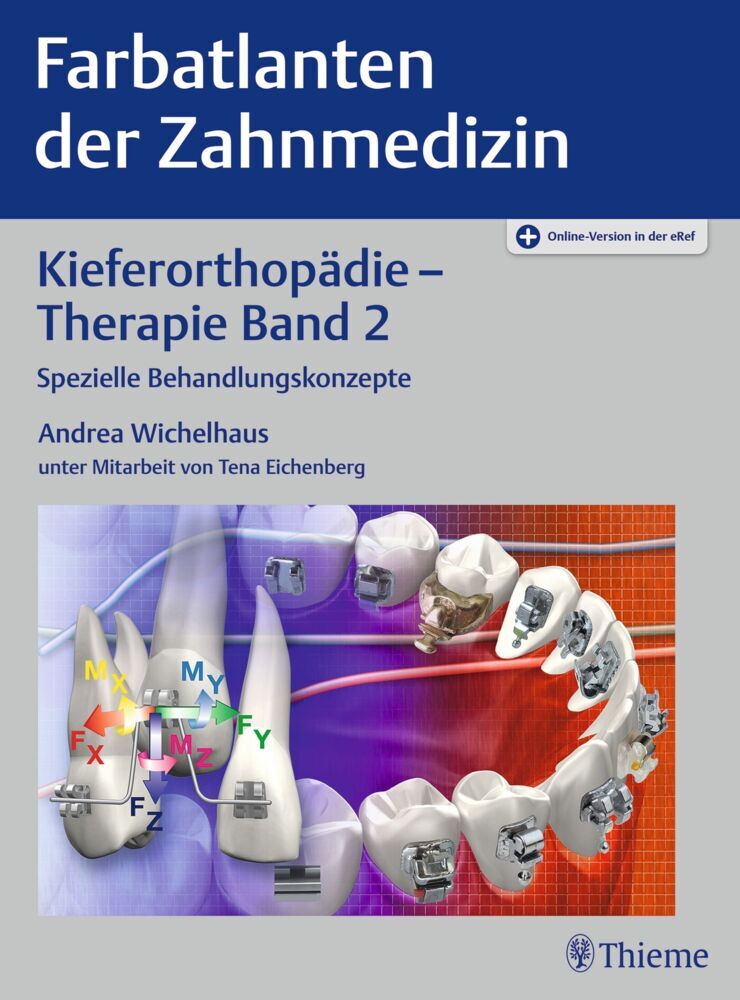 Kieferorthopädie - Therapie Band 2. Bd.2