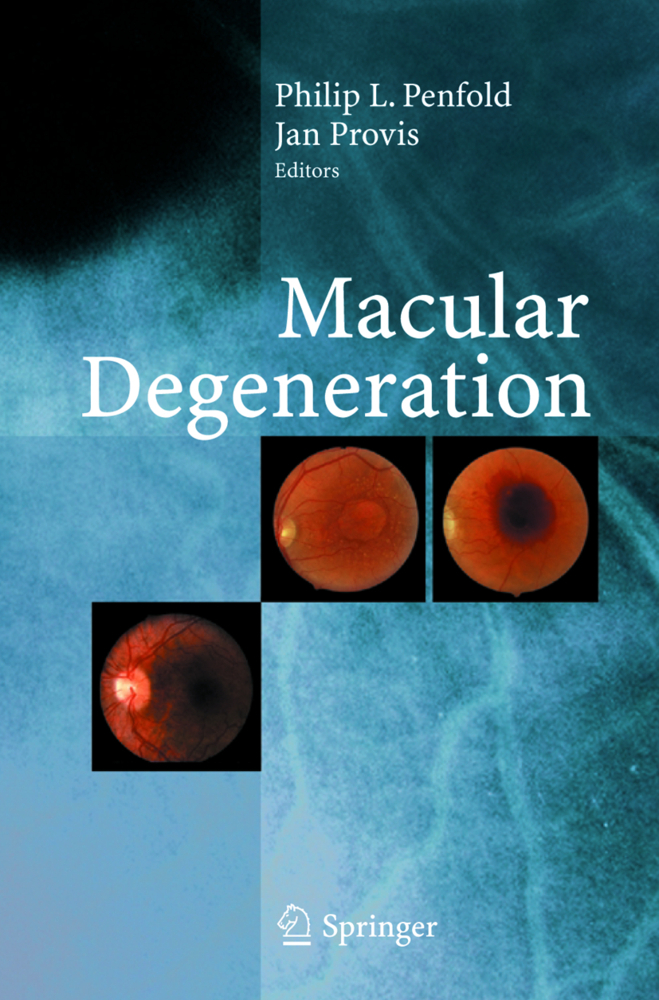 Macular Degeneration