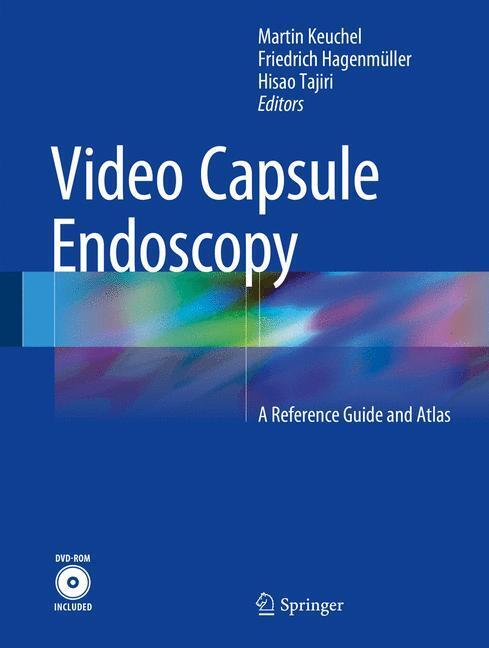 Video Capsule Endoscopy