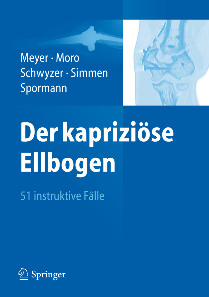 Der kapriziöse Ellbogen