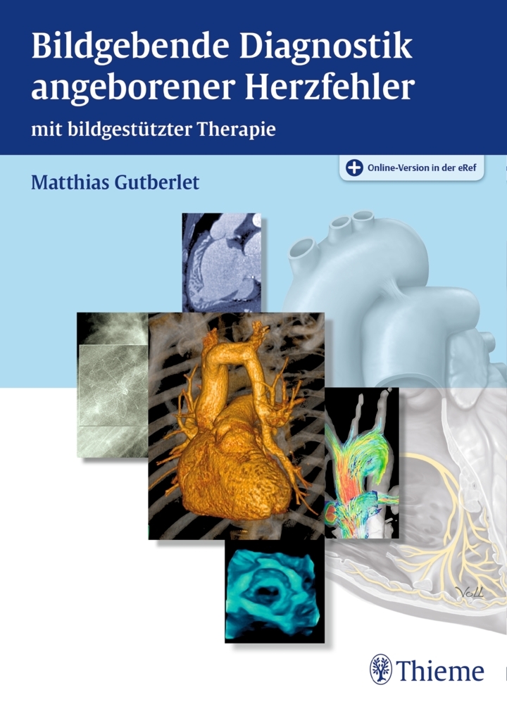 Bildgebende Diagnostik angeborener Herzfehler