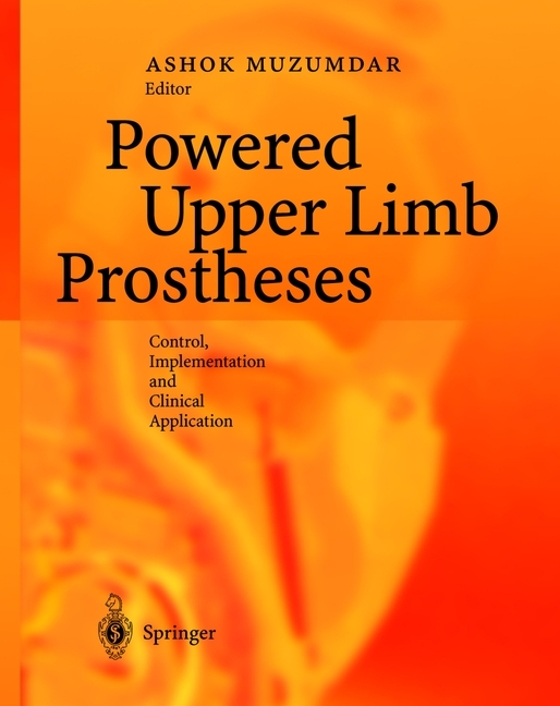 Powered Upper Limb Prostheses