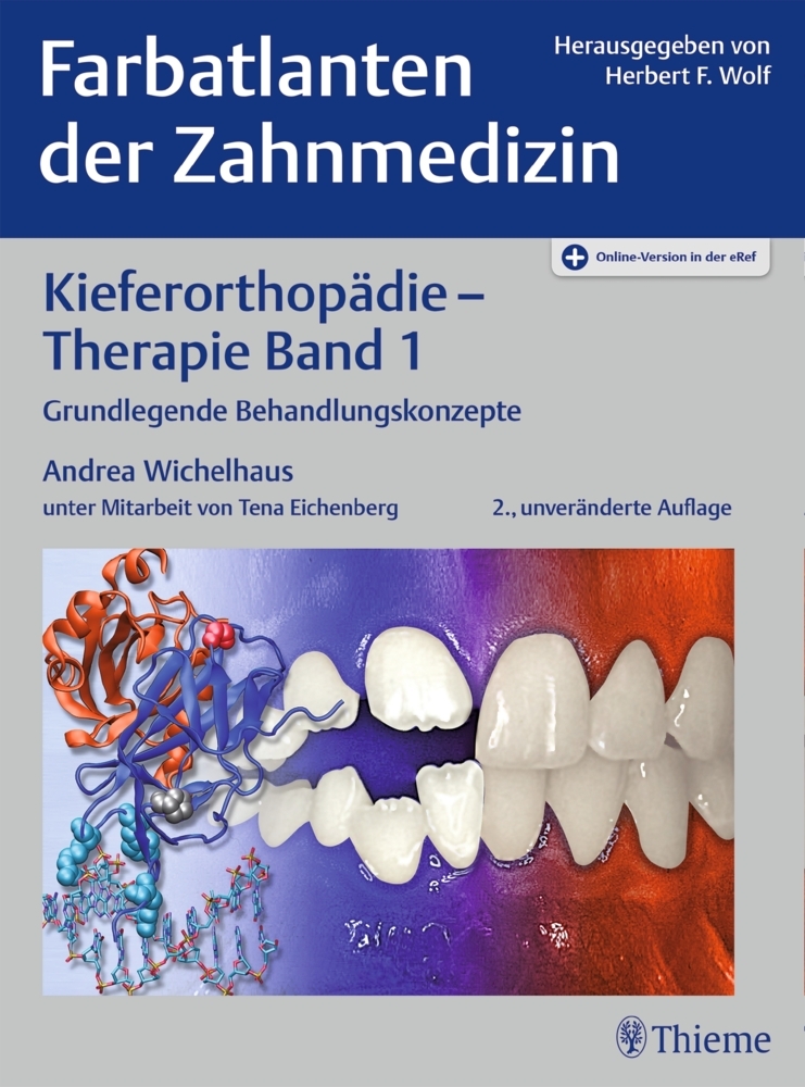 Kieferorthopädie - Therapie Band 1. Bd.1