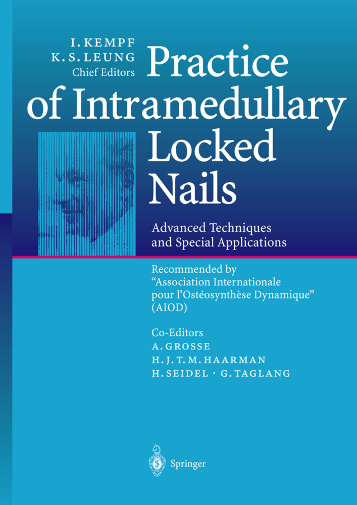 Practice of Intramedullary Locked Nails