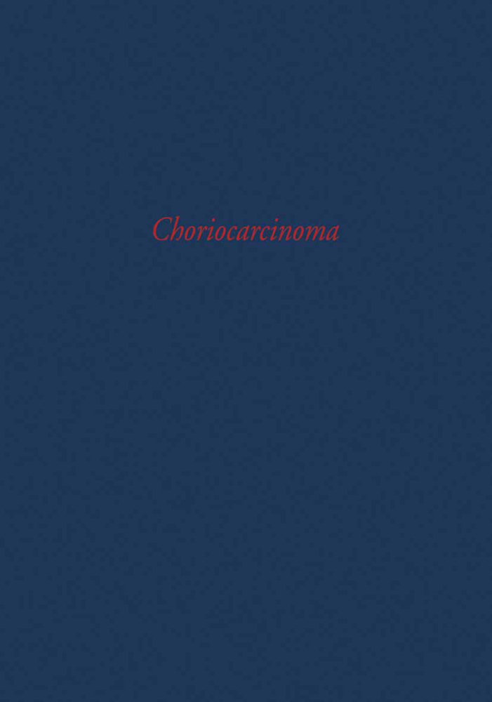 Choriocarcinoma