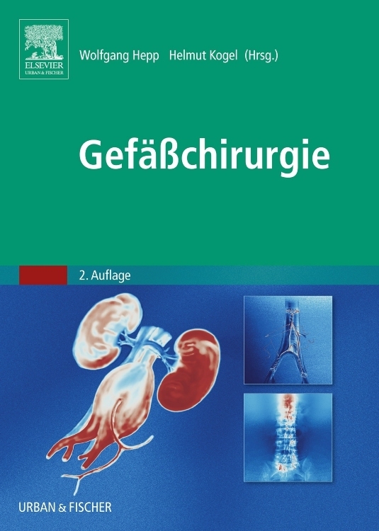 Gefäßchirurgie