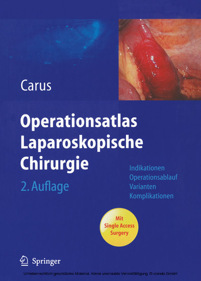 Operationsatlas Laparoskopische Chirurgie