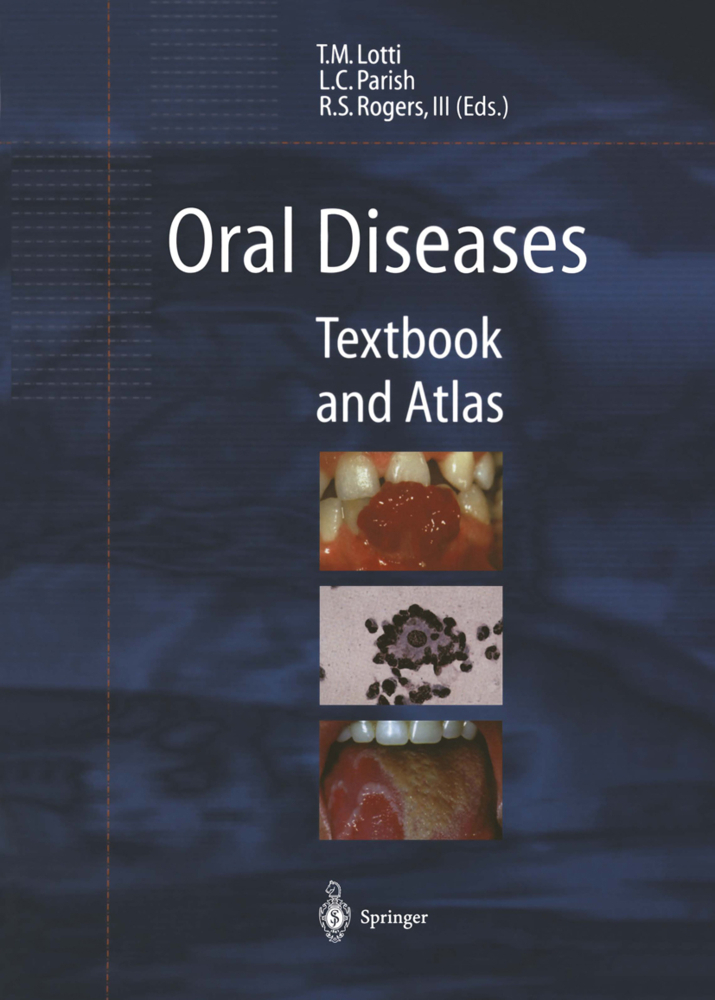 Oral Diseases