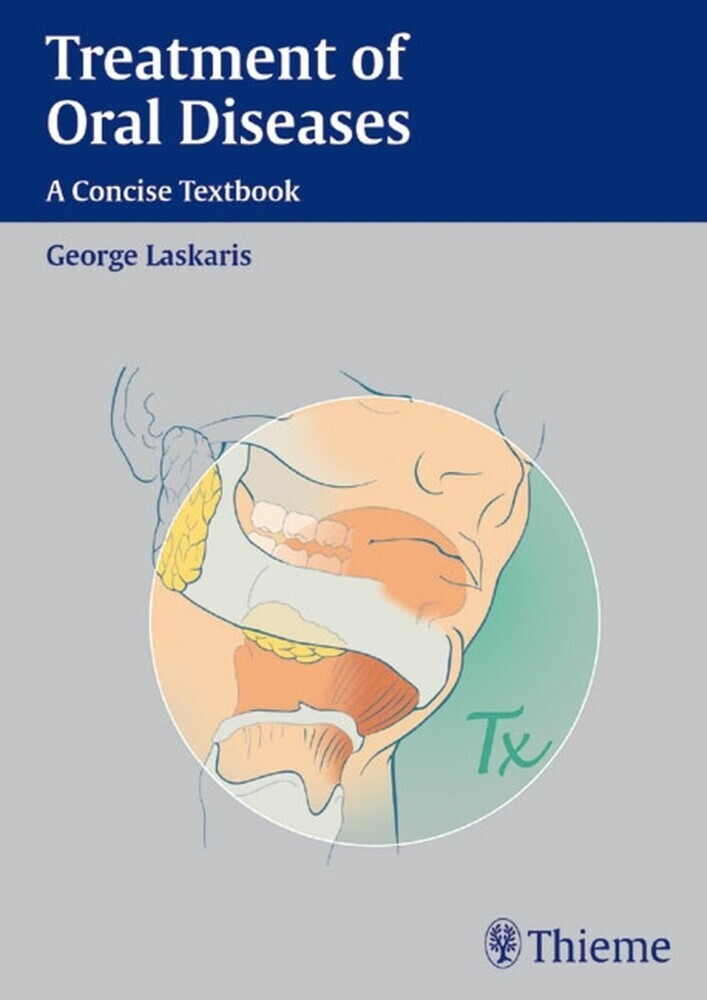 Treatment of Oral Diseases