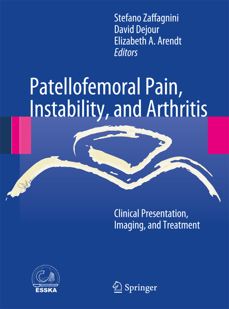 Patellofemoral Pain, Instability, and Arthritis