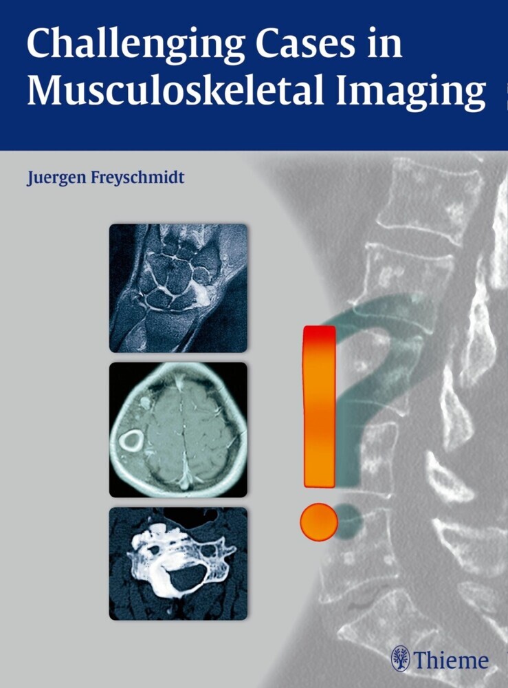 Challenging Cases in Musculoskeletal Imaging