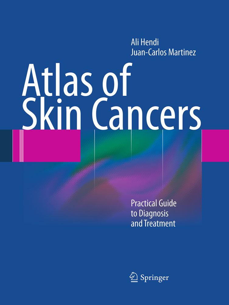 Atlas of Skin Cancers