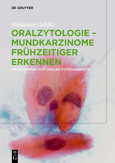 Oralzytologie - Mundkarzinome frühzeitiger erkennen