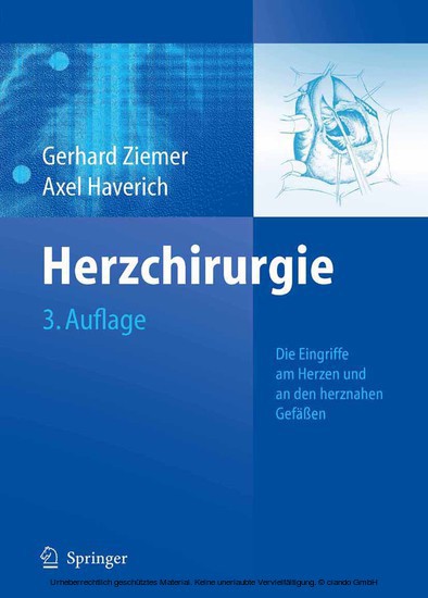 Herzchirurgie