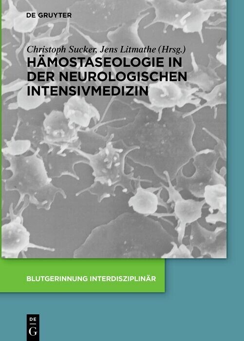 Hämostaseologie in der neurologischen Intensivmedizin