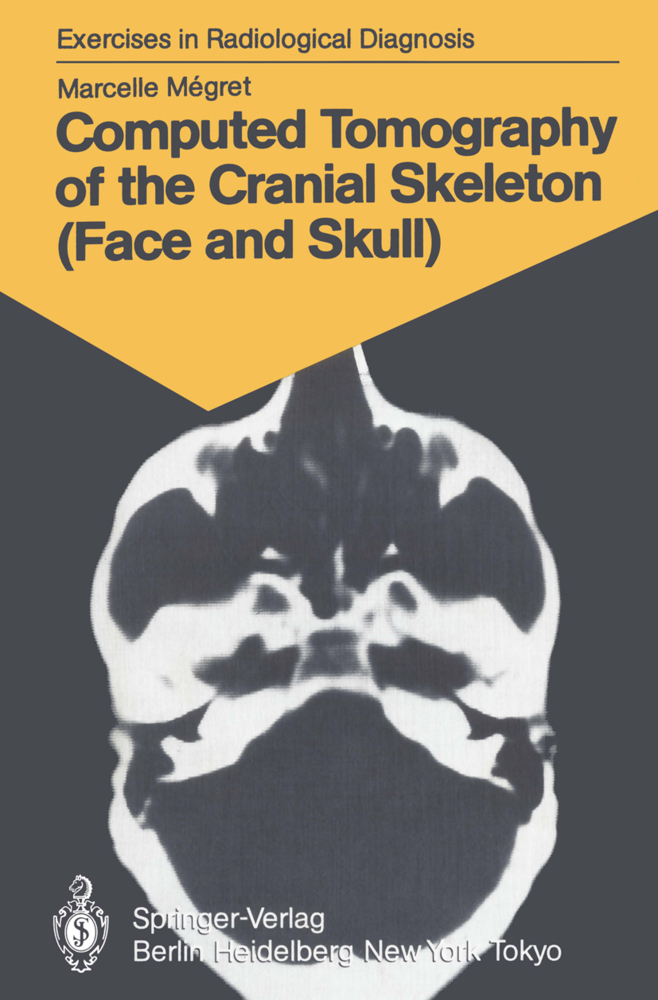 Computed Tomography of the Cranial Skeleton (Face and Skull)