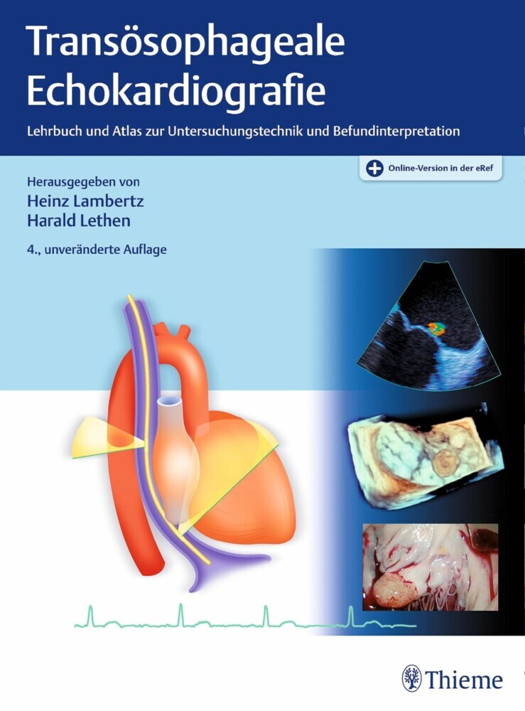 Transösophageale Echokardiografie