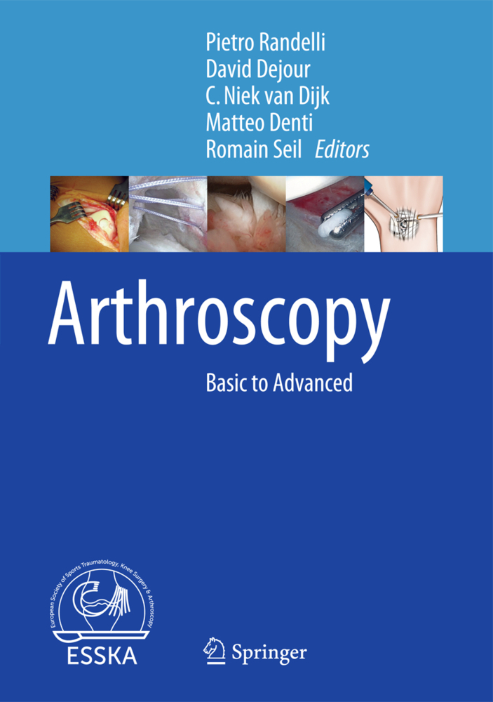 Arthroscopy