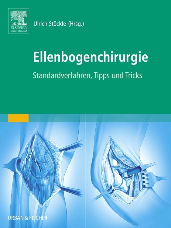 Ellenbogenchirurgie