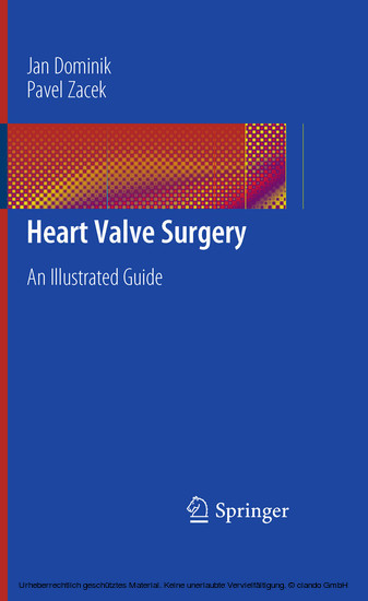 Heart Valve Surgery