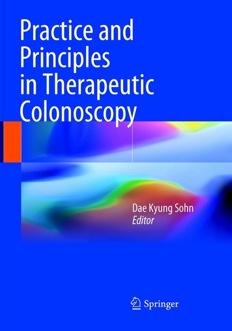 Practice and Principles in Therapeutic Colonoscopy