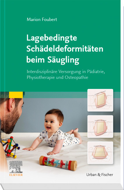 Lagebedingte Schädeldeformitäten beim Säugling