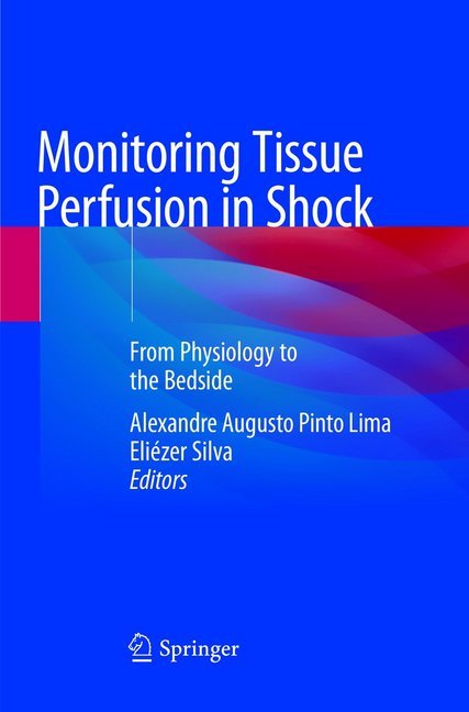 Monitoring Tissue Perfusion in Shock