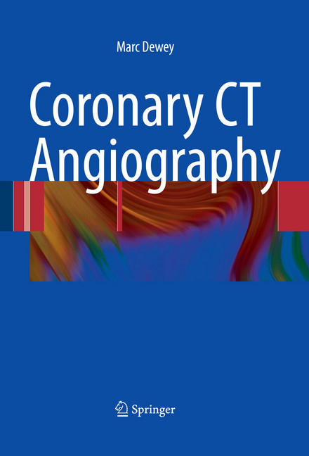 Coronary CT Angiography