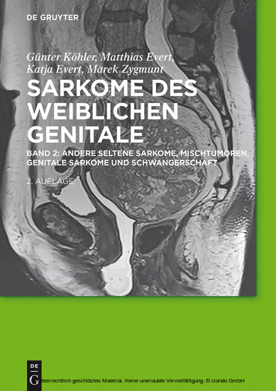 Andere seltene Sarkome,  Mischtumoren, genitale Sarkome und Schwangerschaft