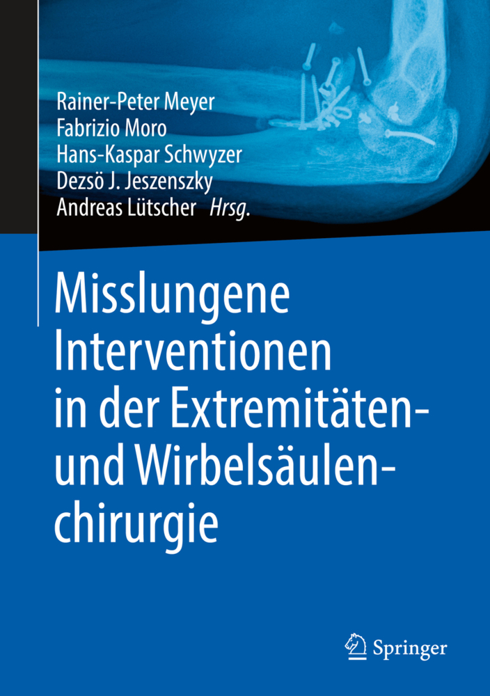 Misslungene Interventionen in der Extremitäten- und Wirbelsäulenchirurgie