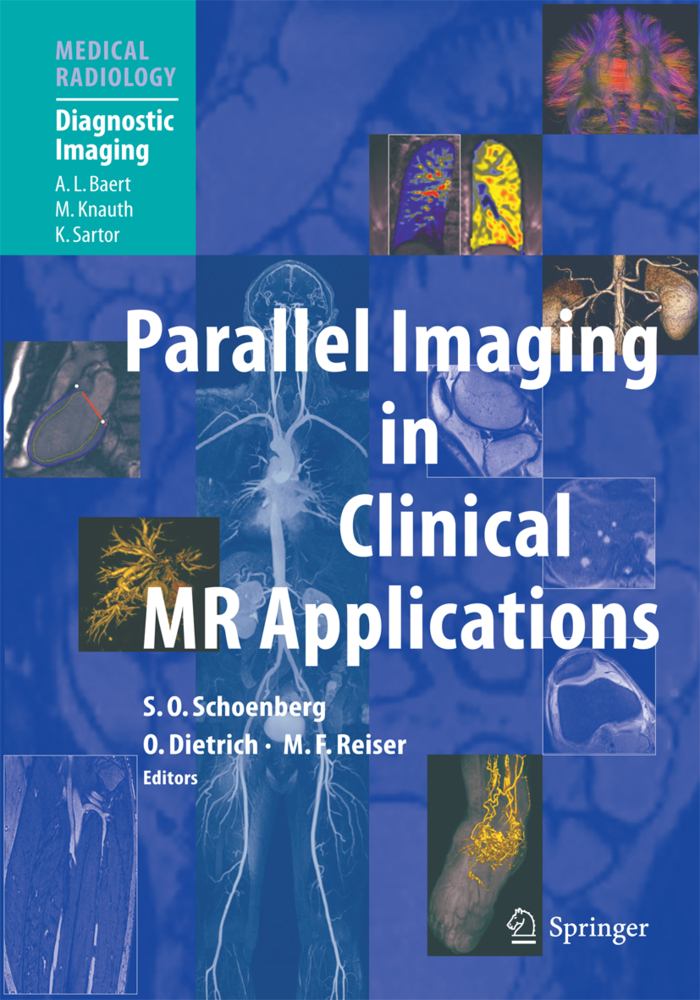 Parallel Imaging in Clinical MR Applications